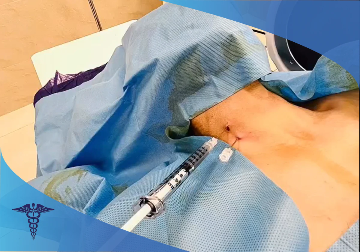 نحوه تزریق دیسکوژل گردن شیراز