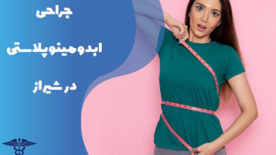 راهنمای جراحی ابدومینوپلاستی در شیراز
