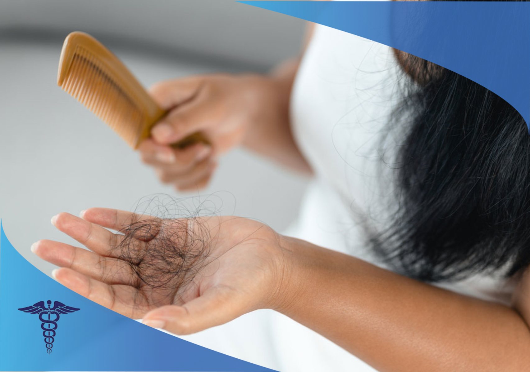 علت های ریزش موی سر؛ چرا کاشت مو بهترین راه‌حل است؟