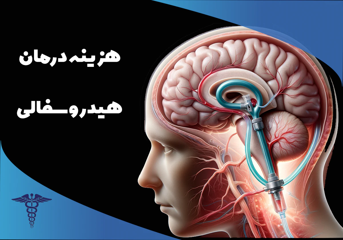 قیمت جراحی شنت در شیراز