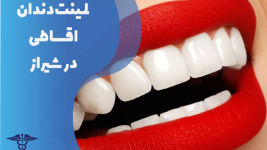 لمینت دندان اقساطی در شیراز
