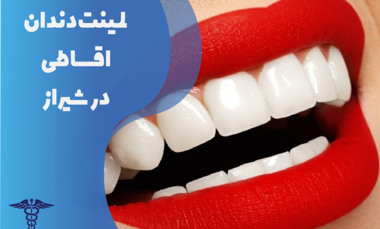 لمینت دندان اقساطی در شیراز