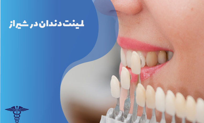 لمینت دندان در شیراز