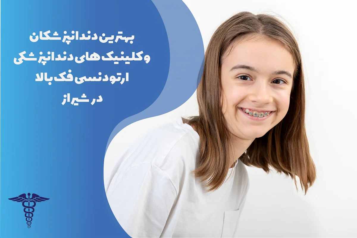 لیست بهترین متخصص ارتودنسی فک بالا در شیراز
