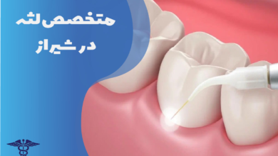 متخصص لثه در شیراز
