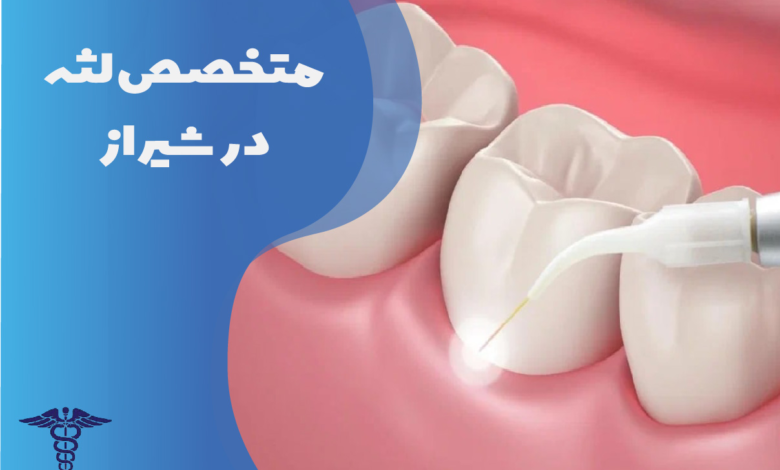 متخصص لثه در شیراز