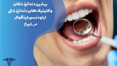 معرفی بهترین کلینیک و متخصص ارتودنسی لینگوال در شیراز