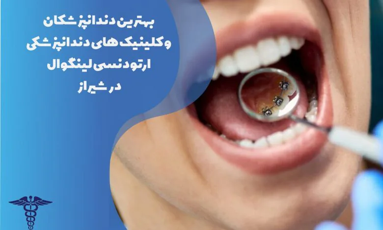 معرفی بهترین کلینیک و متخصص ارتودنسی لینگوال در شیراز