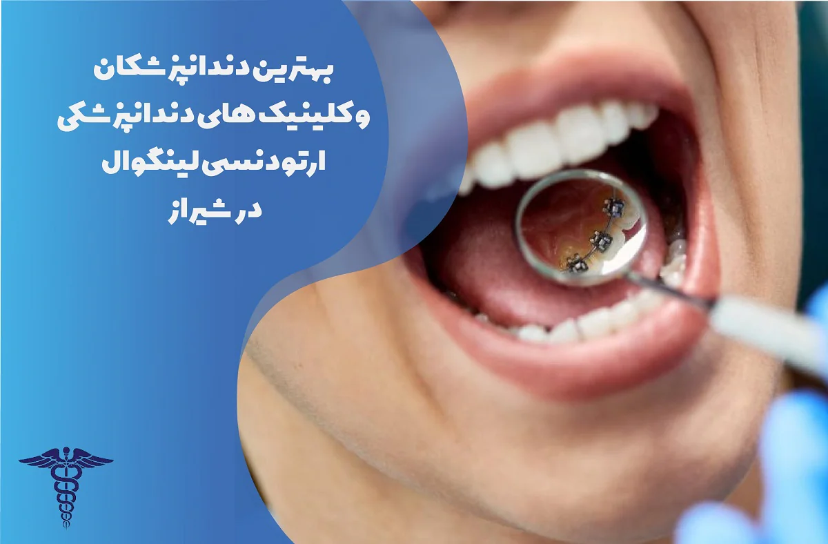 معرفی بهترین کلینیک و متخصص ارتودنسی لینگوال در شیراز