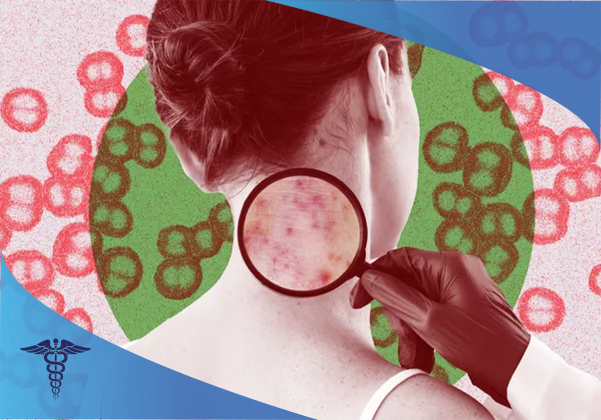 هزینه درمان بیماری مننژیت در شیراز