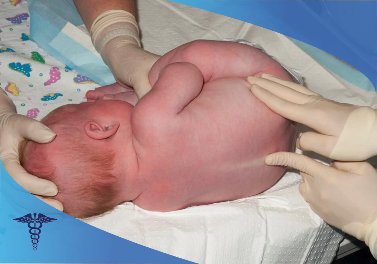 درمان بیماری مننژیت در شیراز؛ روش های تشخیص