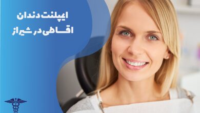 راهنمای ایمپلنت دندان اقساطی در شیراز