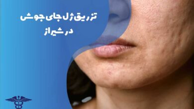 تزریق ژل جای جوش در شیراز