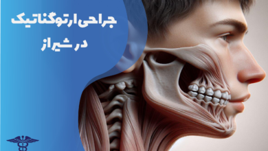 جراحی ارتوگناتیک در شیراز