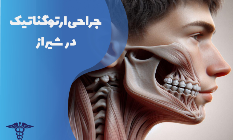 جراحی ارتوگناتیک در شیراز