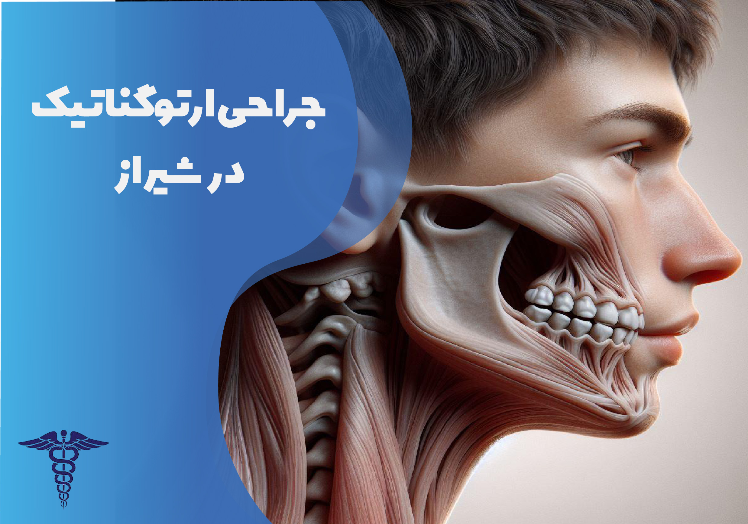 جراحی ارتوگناتیک در شیراز