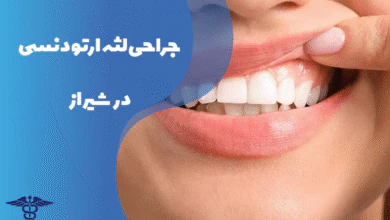 جراحی لثه ارتودنسی در شیراز
