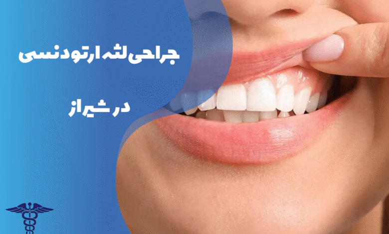 جراحی لثه ارتودنسی در شیراز