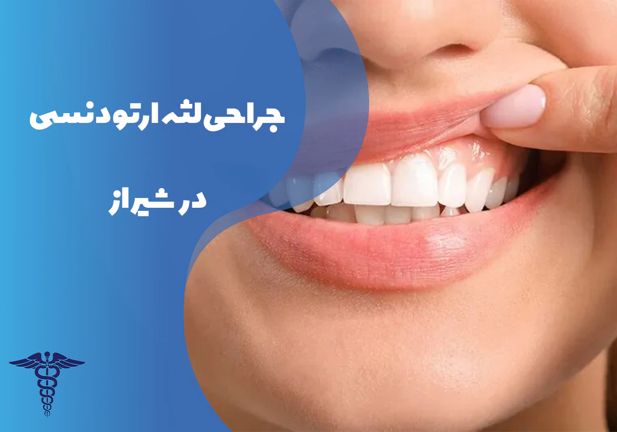جراحی لثه ارتودنسی در شیراز