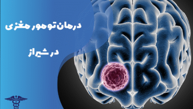 درمان تومور مغزی در شیراز