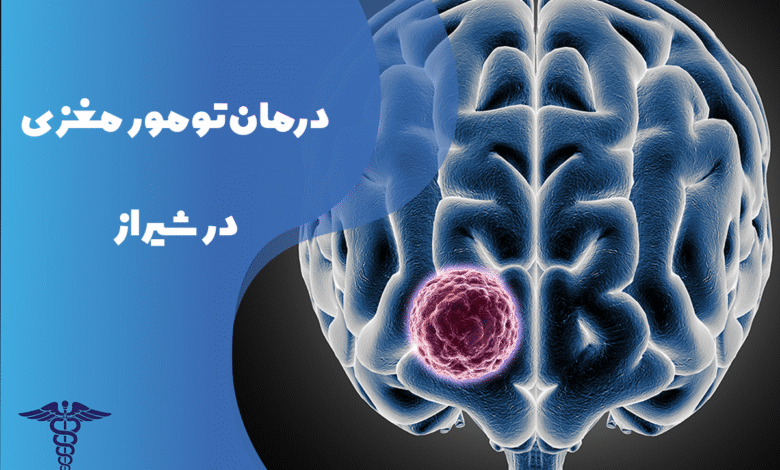 درمان تومور مغزی در شیراز