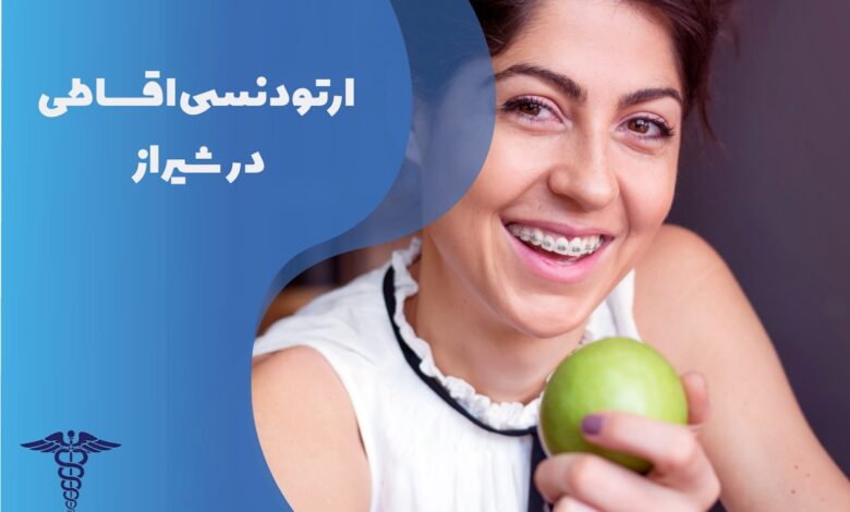راهنمای جامع ارتودنسی دندان اقساطی در شیراز و شرایط آن