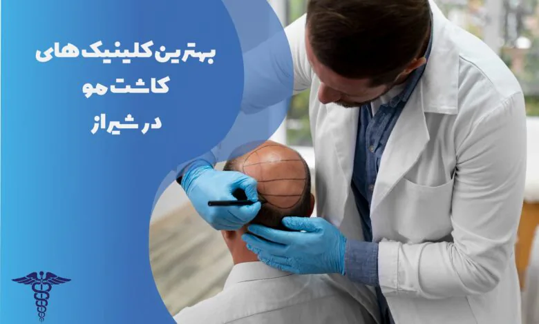 لیست بهترین کلینیک های کاشت مو در شیراز به همراه مشخصات