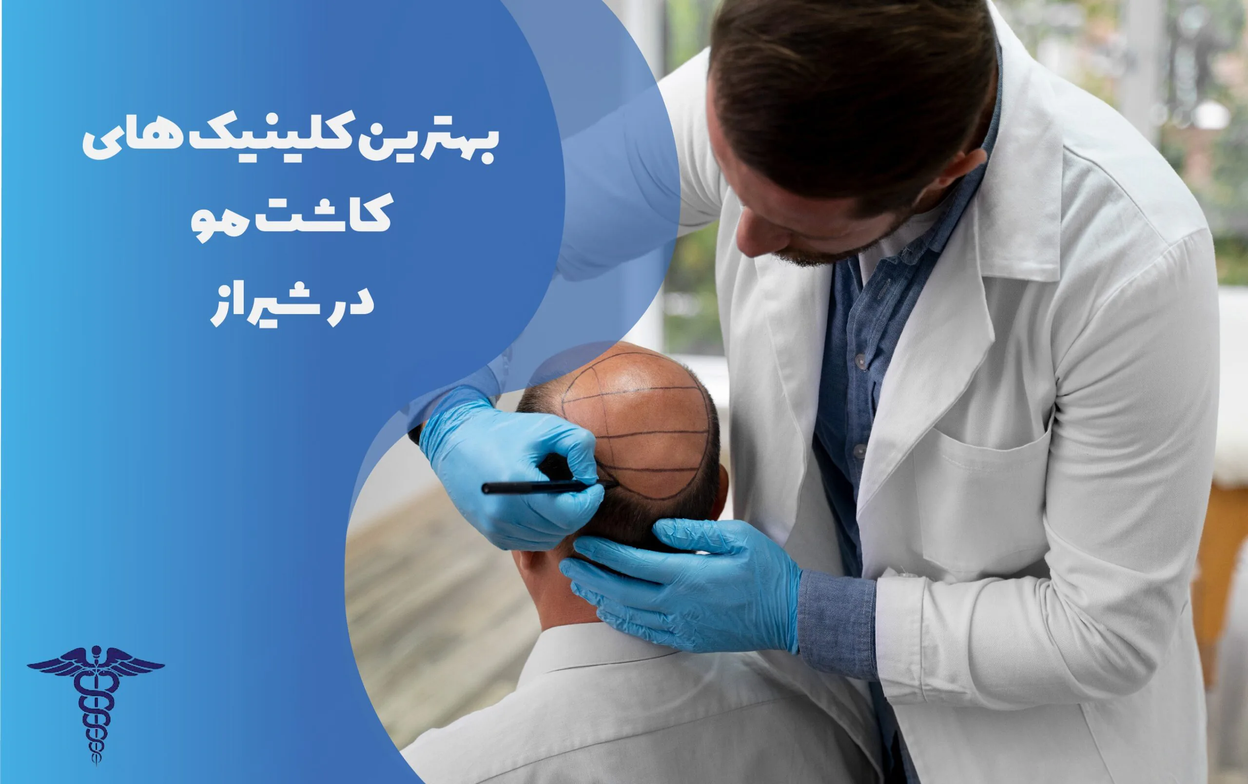 لیست بهترین کلینیک های کاشت مو در شیراز به همراه مشخصات