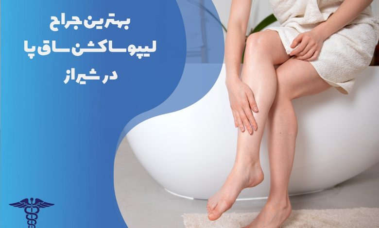 بهترین جراح لیپوساکشن ساق پا در شیراز