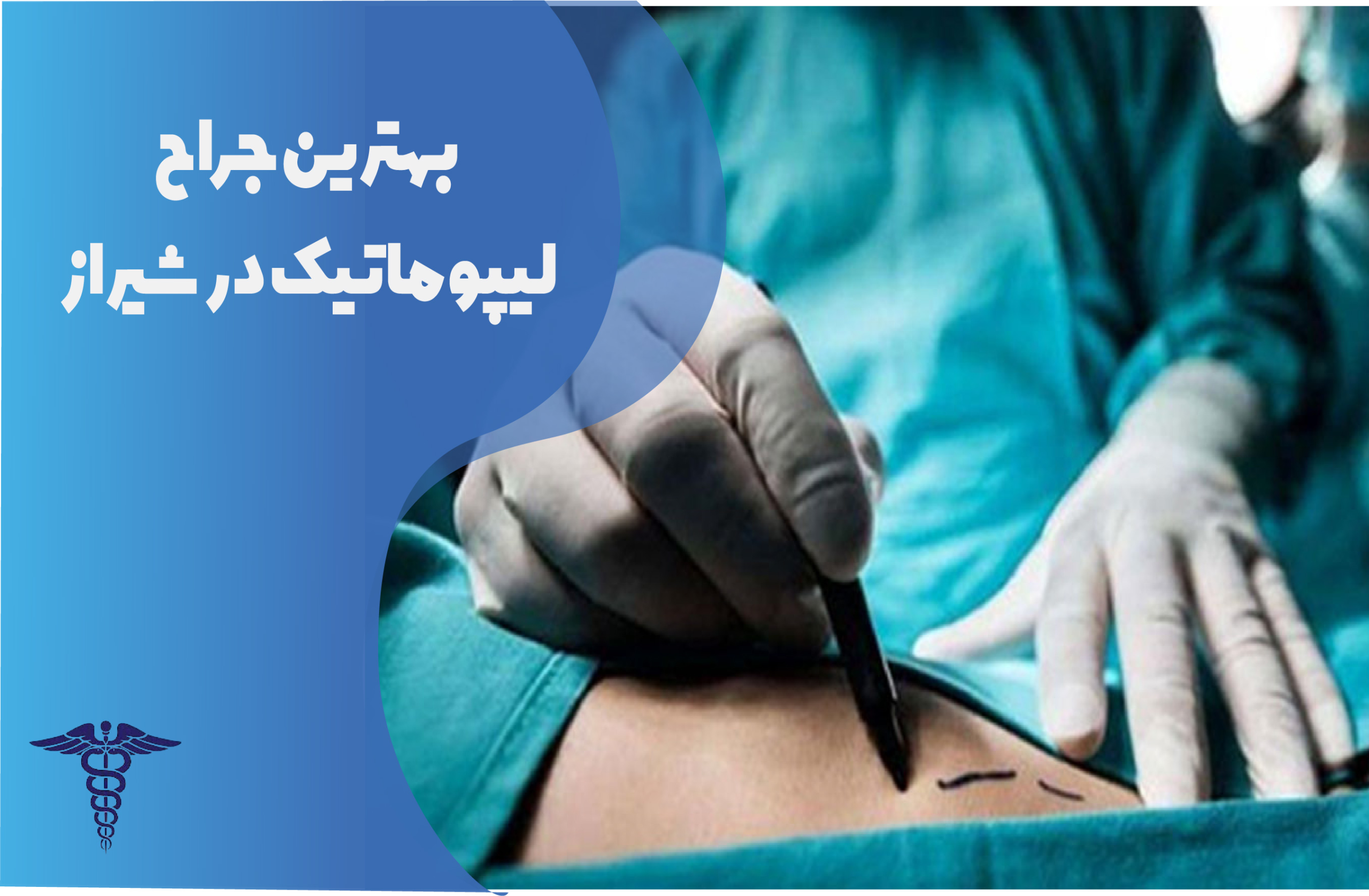 بهترین جراح لیپوماتیک در شیراز