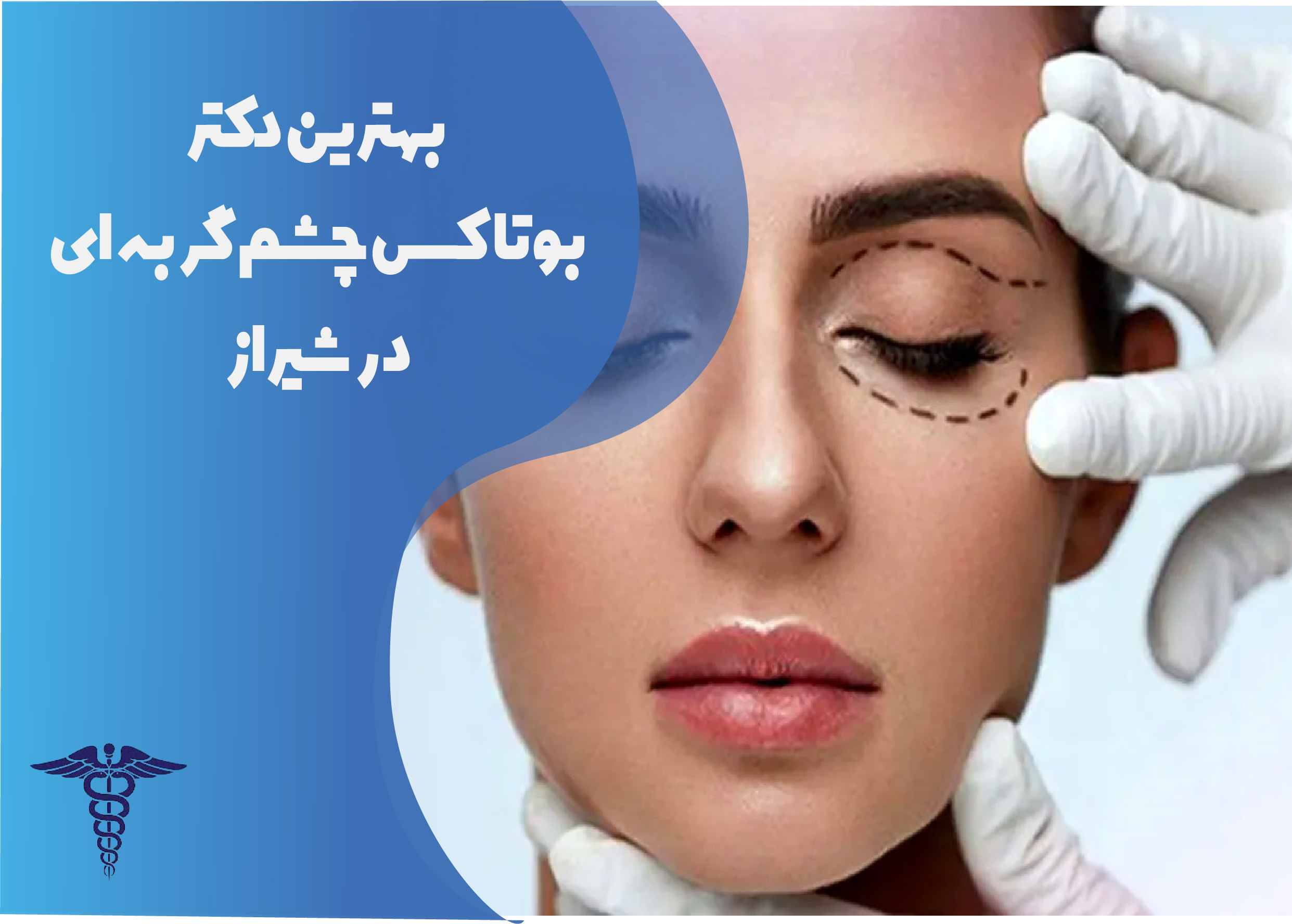 بهترین دکتر بوتاکس چشم گربه‌ای در شیراز