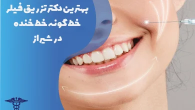 بهترین دکتر تزریق خط گونه خط خنده در شیراز