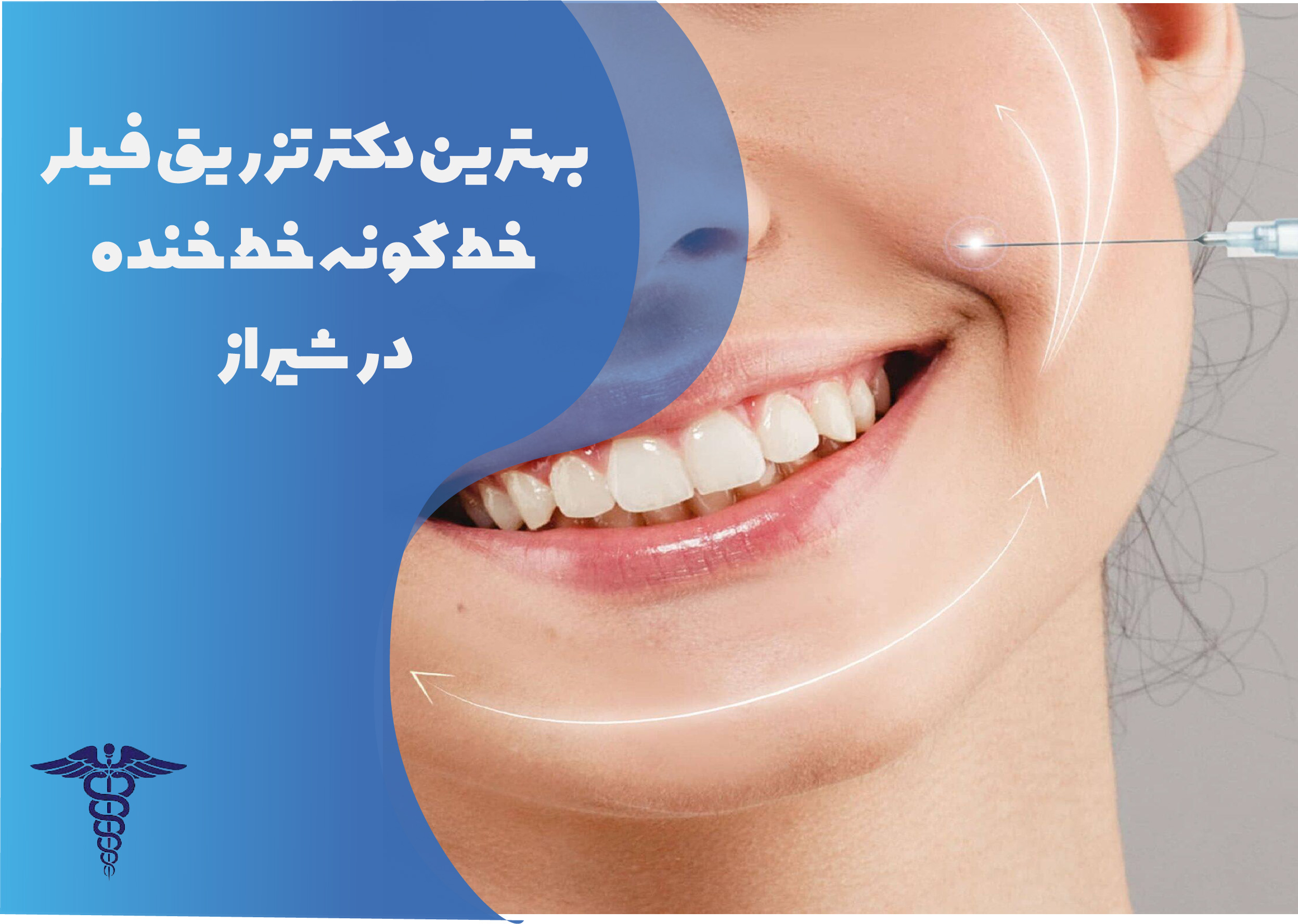 بهترین دکتر تزریق خط گونه خط خنده در شیراز
