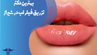 بهترین دکتر تزریق فیلر لب در شیراز