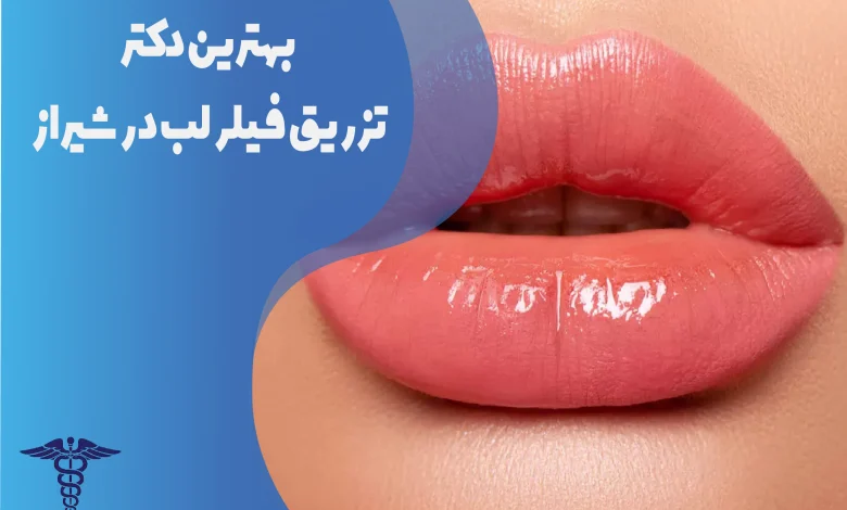 بهترین دکتر تزریق فیلر لب در شیراز