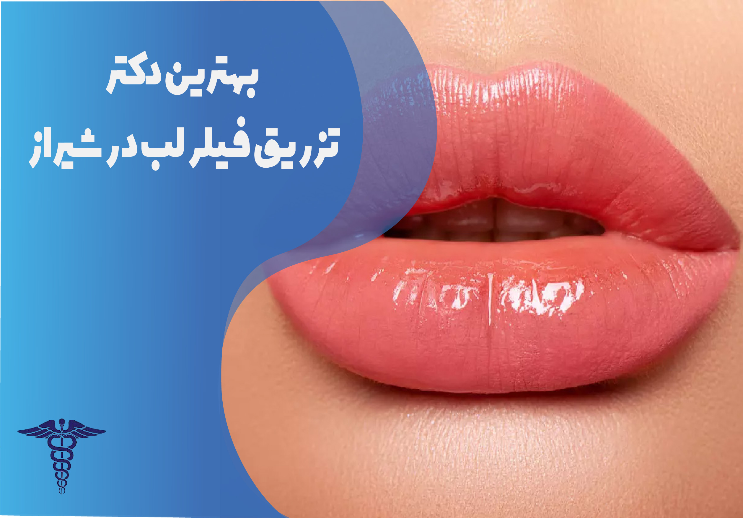 بهترین دکتر تزریق فیلر لب در شیراز