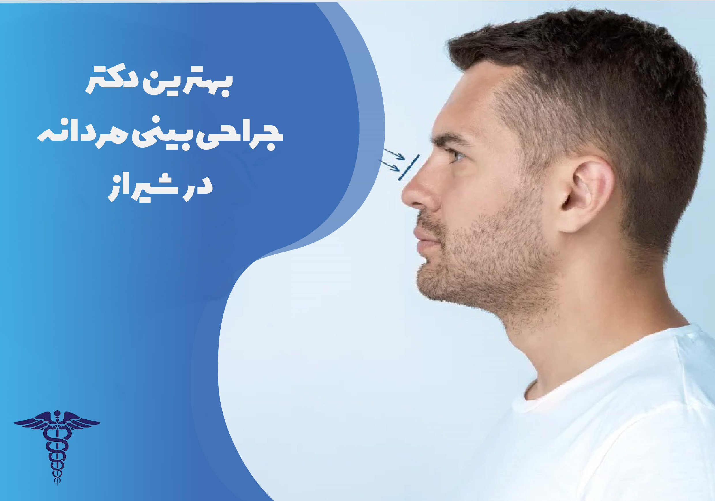 بهترین دکتر جراحی بینی مردانه در شیراز