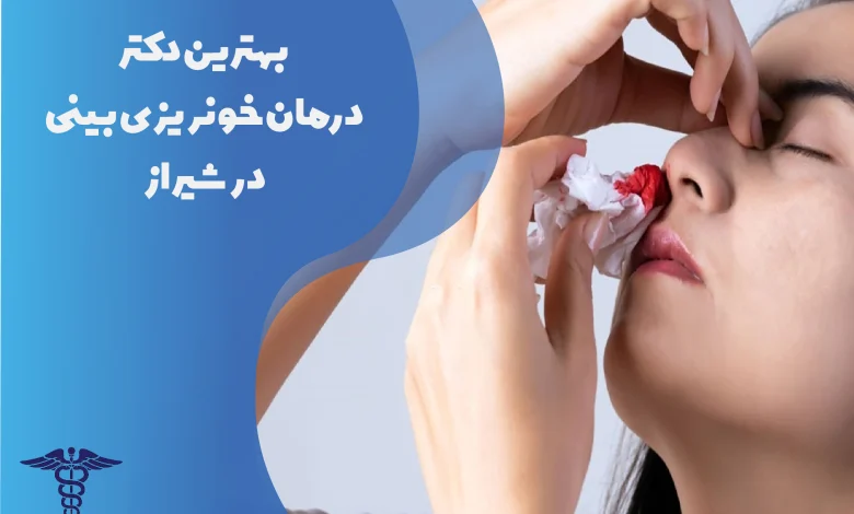 بهترین دکتر درمان خونریزی بینی در شیراز