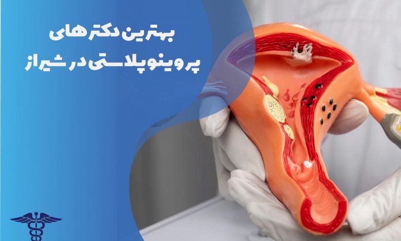 بهترین دکتر پرینوپلاستی در شیراز