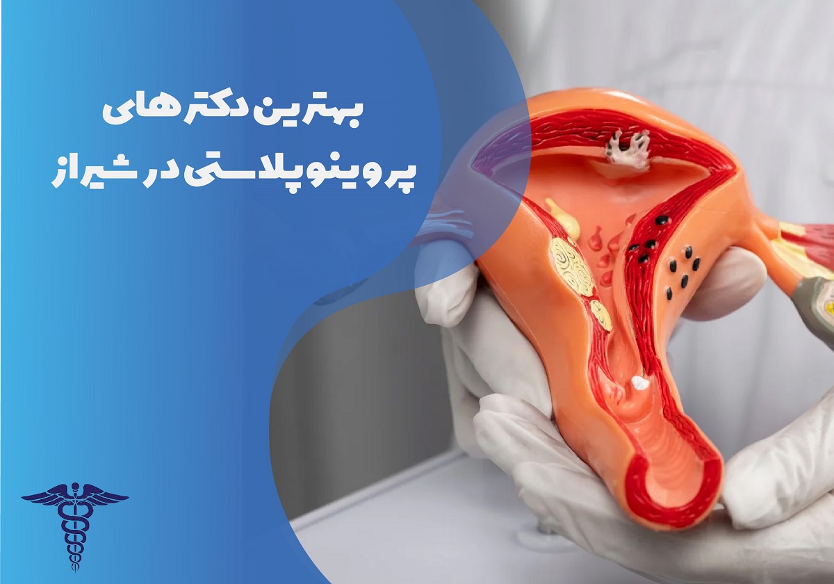 معرفی 12 دکتر برتر پرینوپلاستی در شیراز – بهترین دکتر پرینوپلاستی شیراز کیست؟