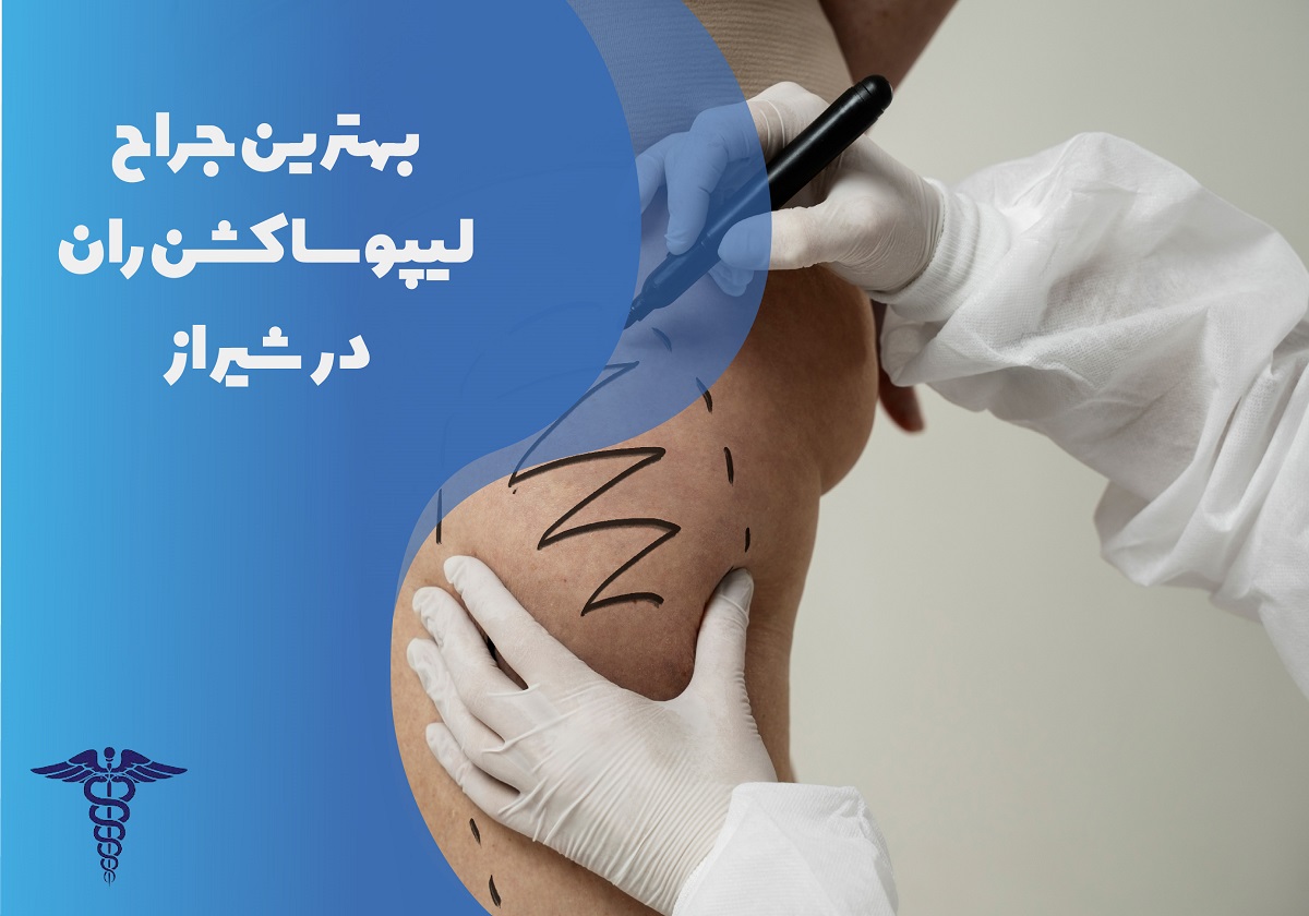 لیست بهترین جراح لیپوساکشن ران در شیراز
