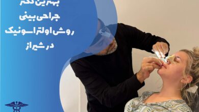 لیست بهترین دکتر جراحی بینی روش اولتراسونیک در شیراز