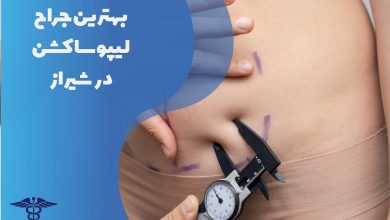 معرفی بهترین جراح لیپوساکشن در شیراز
