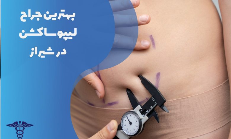 معرفی بهترین جراح لیپوساکشن در شیراز