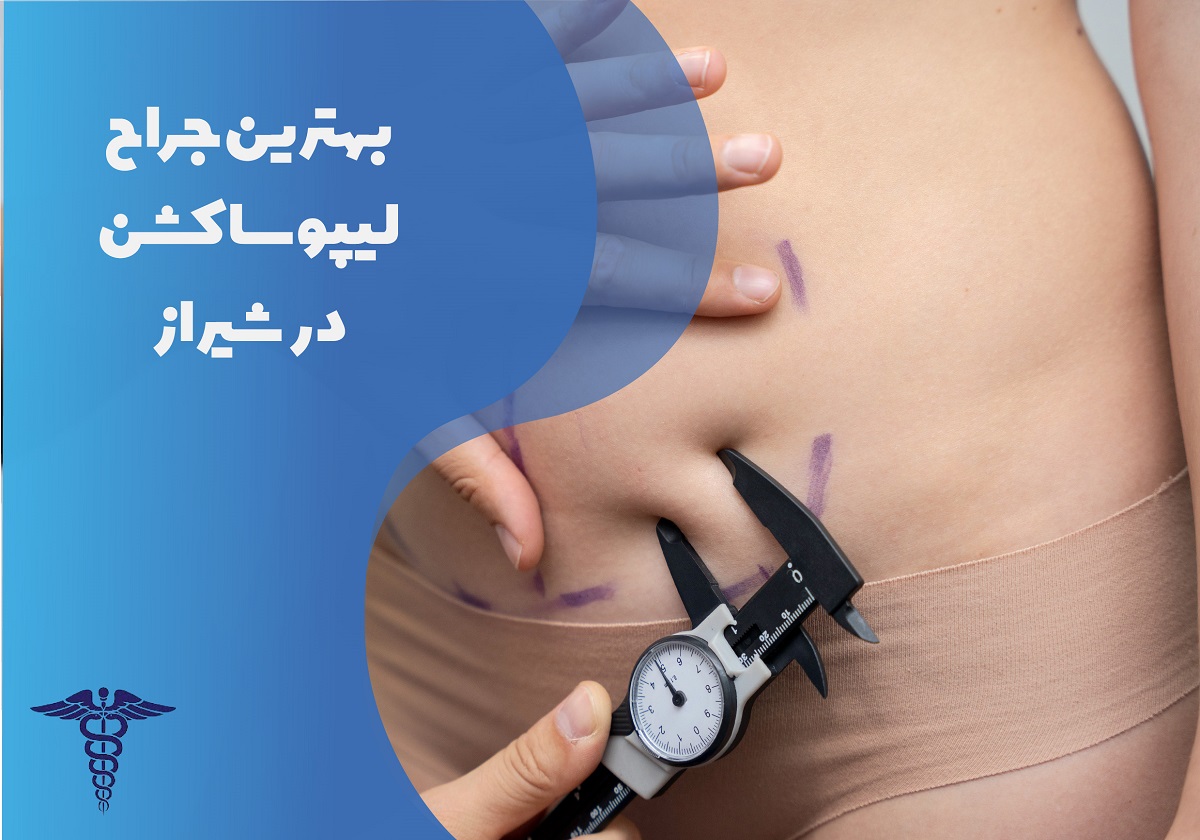 معرفی بهترین جراح لیپوساکشن در شیراز