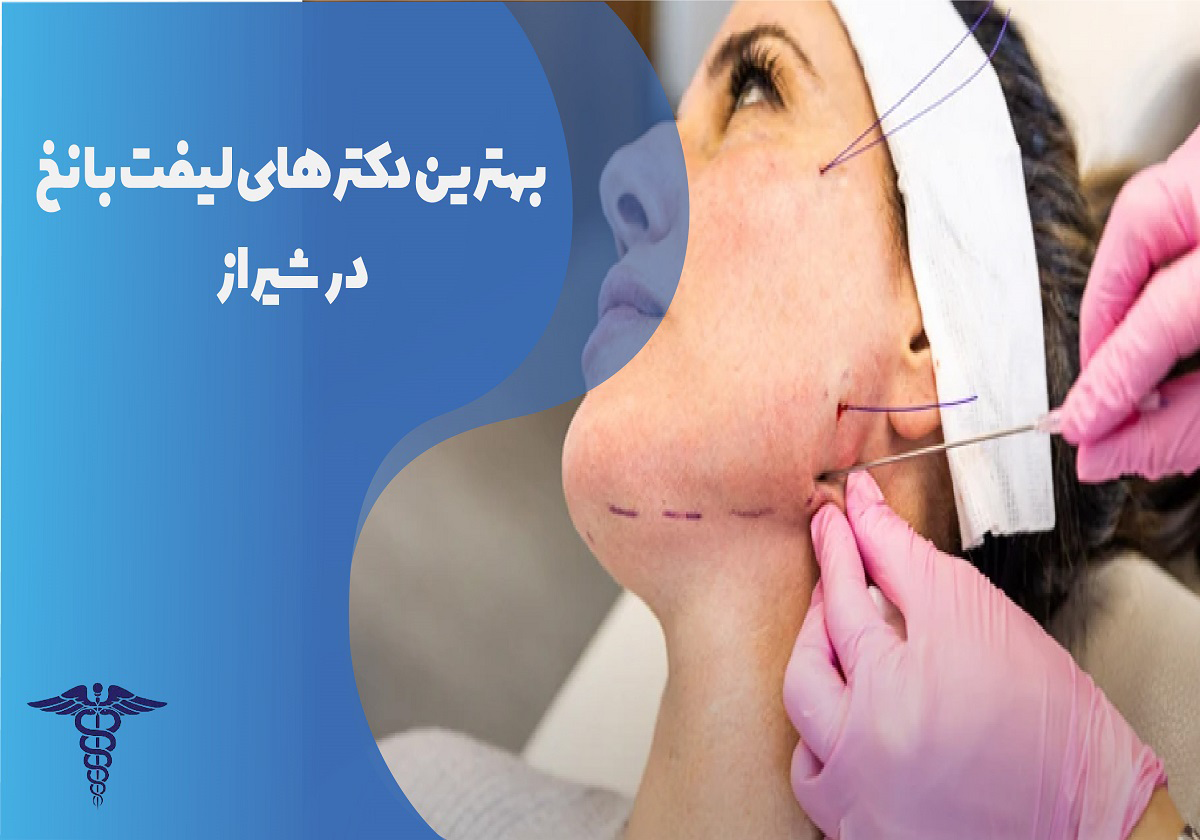 بهترین دکتر لیفت با نخ در شیراز