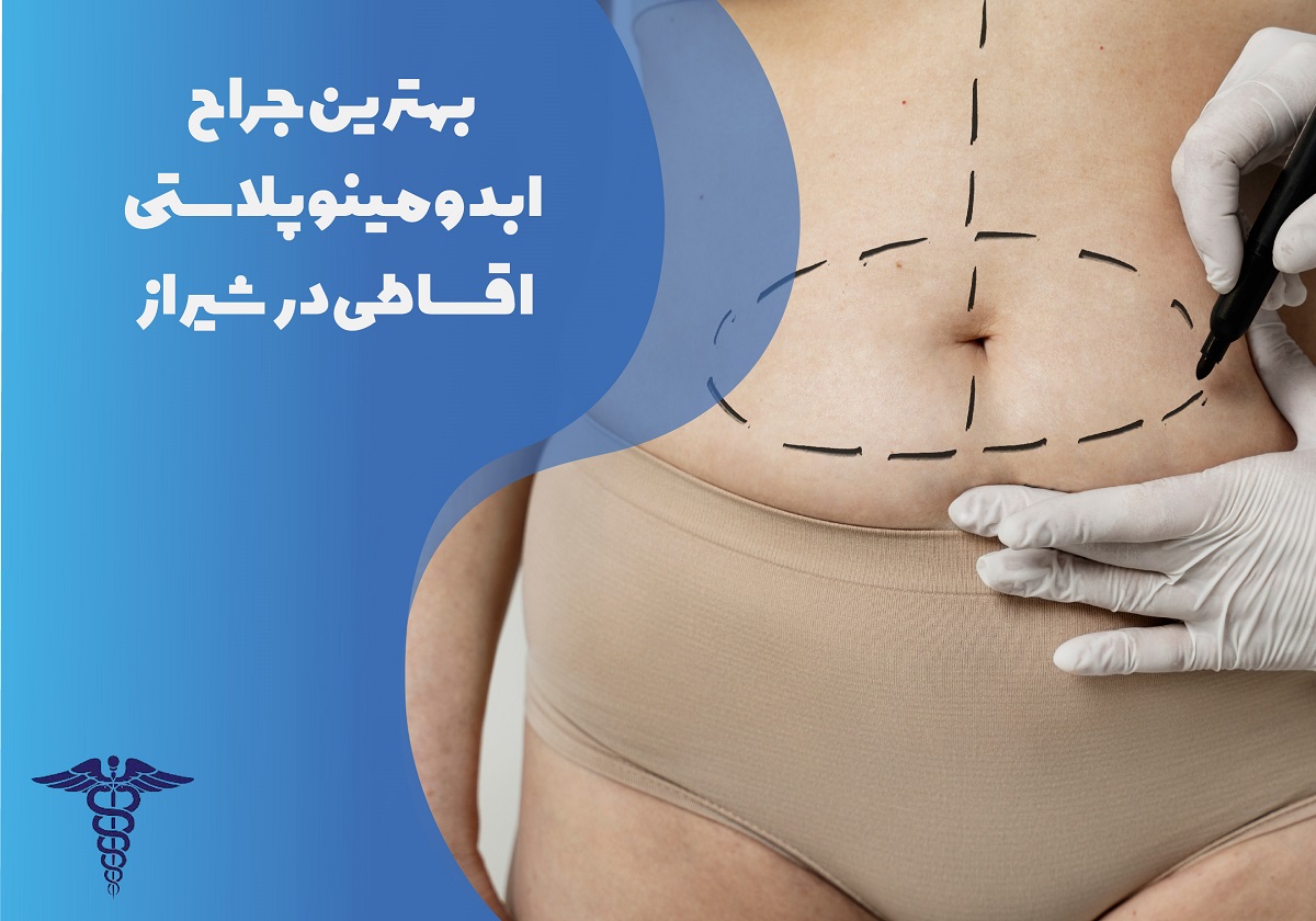 بهترین جراح ابدومینوپلاستی اقساطی در شیراز