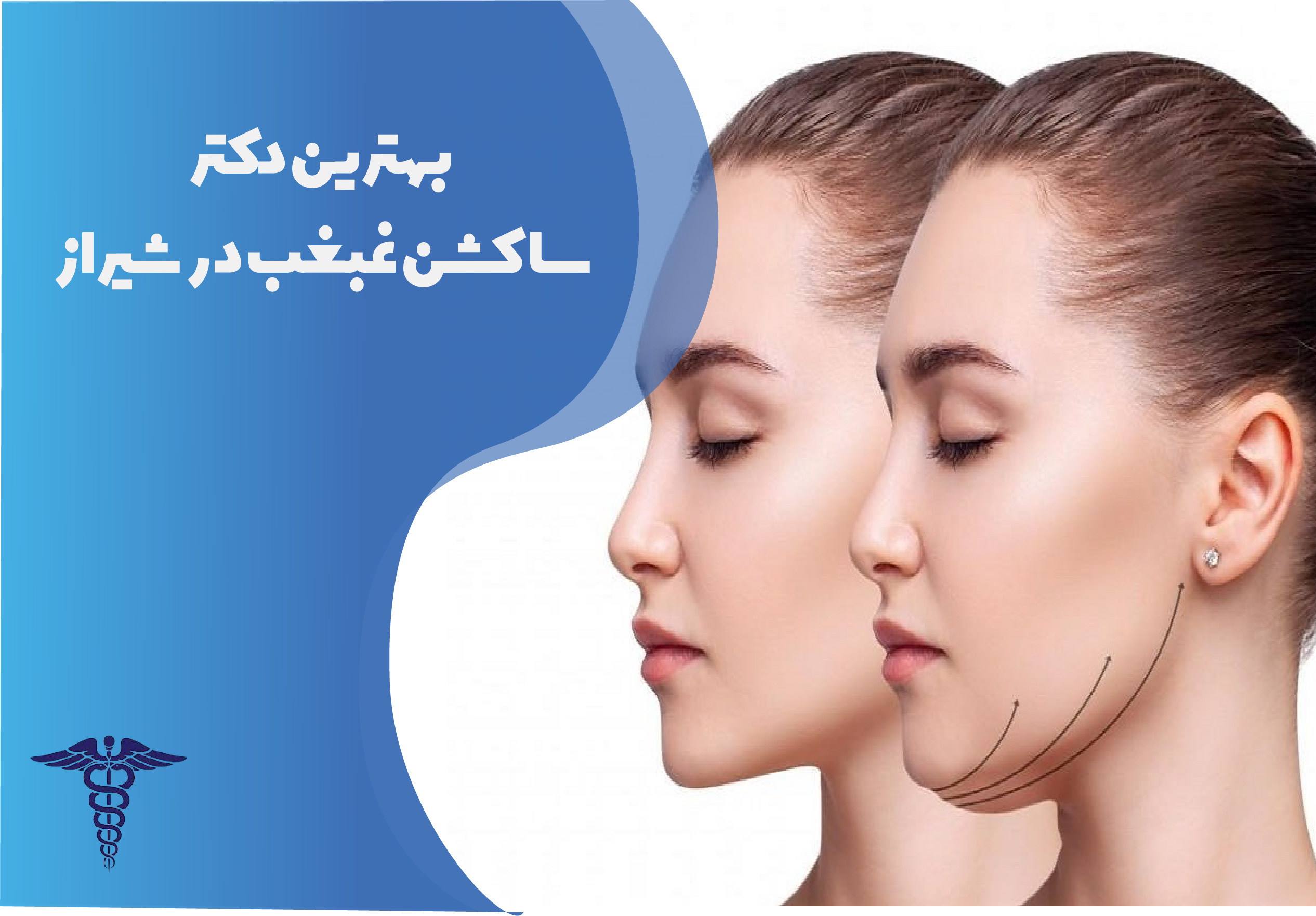 بهترین دکتر ساکشن غبغب در شیراز