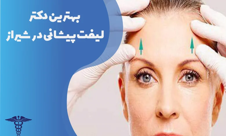 بهترین دکتر لیفت پیشانی در شیراز