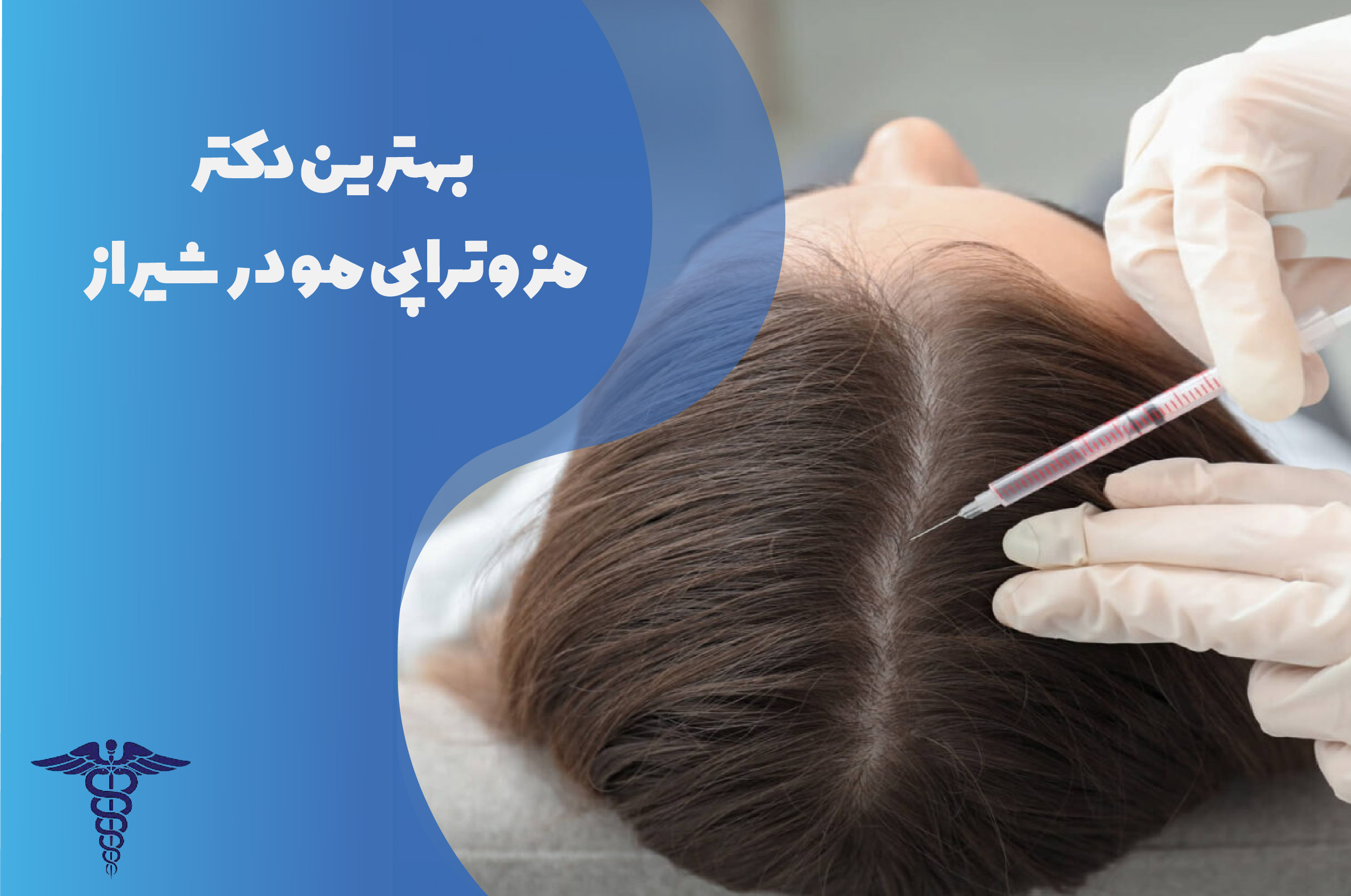 بهترین دکتر مزوتراپی مو در شیراز